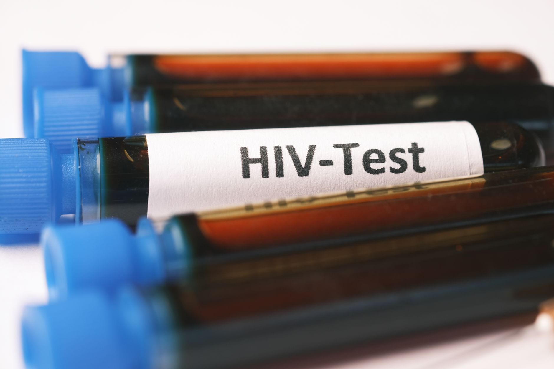 STI-Tests in der Apotheke: Die nächste Ausbaustufe der Offizin?